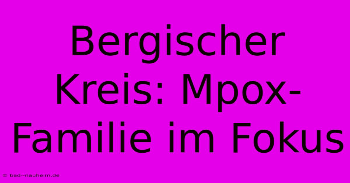 Bergischer Kreis: Mpox-Familie Im Fokus